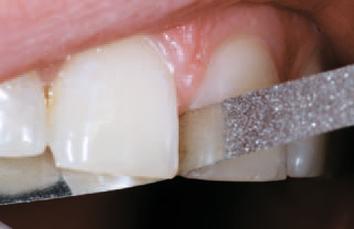 Алмазная полоска NTI